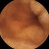 this-intestine-does-not-exist
