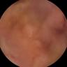 this-intestine-does-not-exist