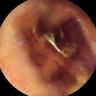 this-intestine-does-not-exist