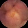 this-intestine-does-not-exist