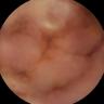 this-intestine-does-not-exist