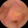 this-intestine-does-not-exist