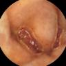 this-intestine-does-not-exist