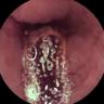 this-intestine-does-not-exist