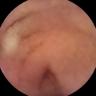 this-intestine-does-not-exist