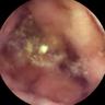 this-intestine-does-not-exist