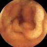 this-intestine-does-not-exist
